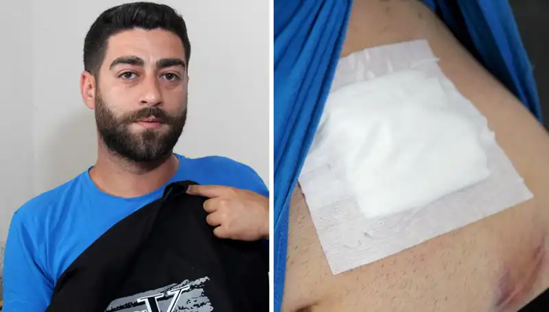 Karnında Hissettiği Ağrı Sonrası Şok Edici Röntgen Sonucu!