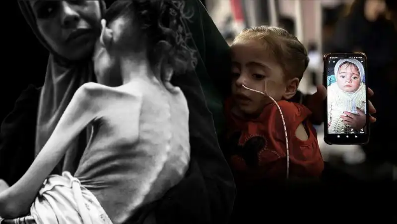 Küçük Meryem'in Korkunç Hikayesi: 25 Kilodan 10 Kiloya Düşüşü